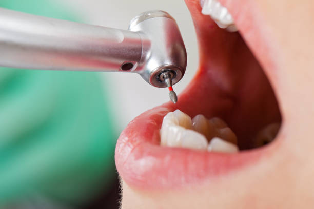 Best Emergency Broken Tooth Repair in Mcqueeney, TX